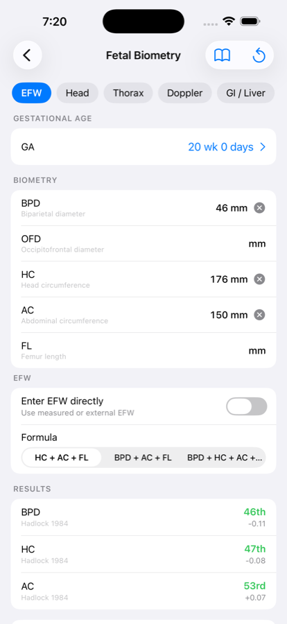 Fetal biometry panel with z-scores and percentiles